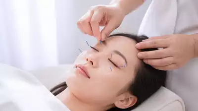 User receiving acupuncture treatment for eyes